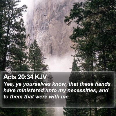 Acts 20:34 KJV Bible Verse Image