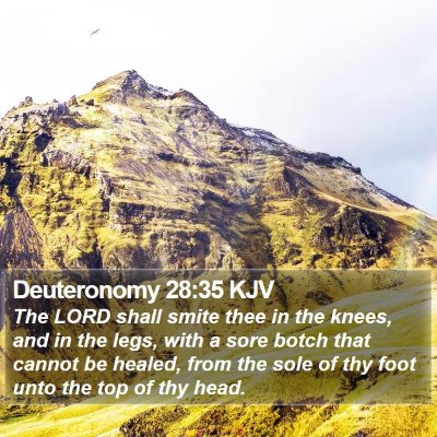 Deuteronomy 28:35 KJV Bible Verse Image