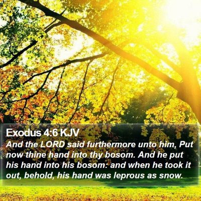 Exodus 4:6 KJV Bible Verse Image