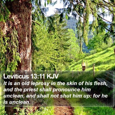 Leviticus 13:11 KJV Bible Verse Image